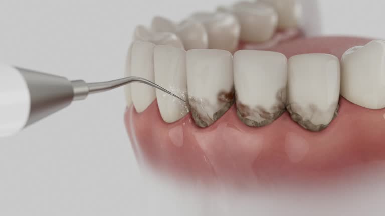 Reliable Dental Implants contractor in Cleary, MS by Smile Center Dentistry
